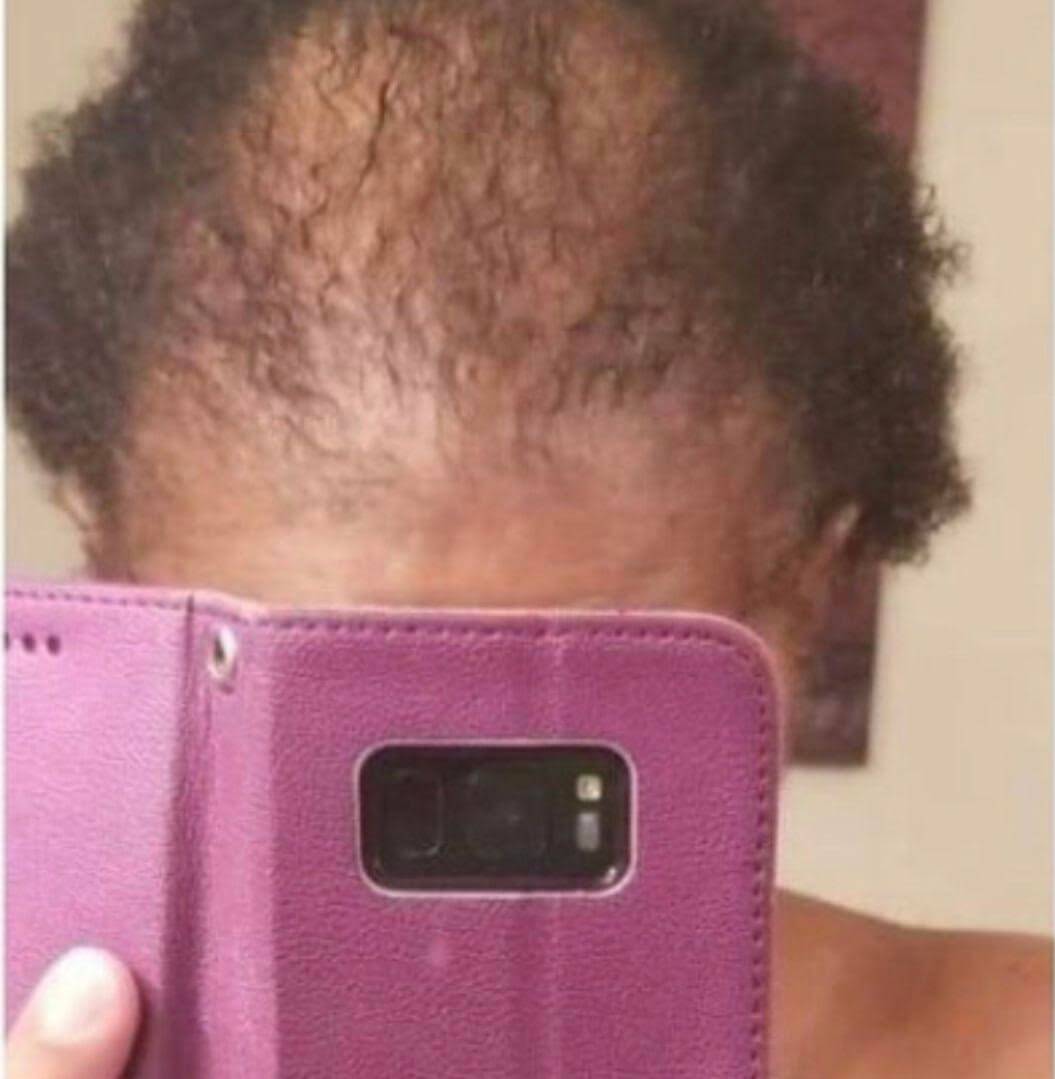 before shot before using hair growth serum